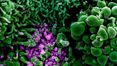  There are good reasons to believe that developing and emerging economies will ravaged far more by the coronavirus pandemic than the advanced economies have been. Photograph: NIAID/Reuters